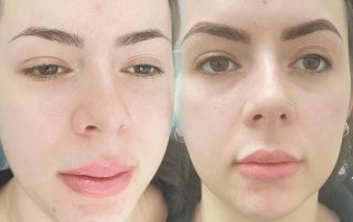 Feathering Eyebrows before after in Melbourne