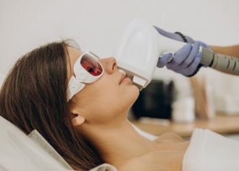 Facial laser hair removal