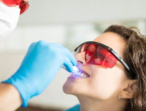 Laser Teeth Whitening Treatment Melbourne